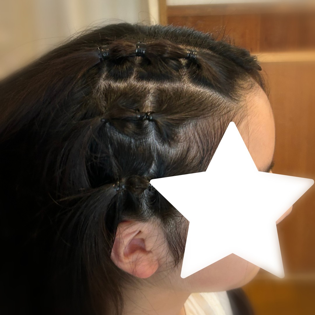 ゴム編み込みを後ろから見たところ。結び目が連なって編み込みのように見える